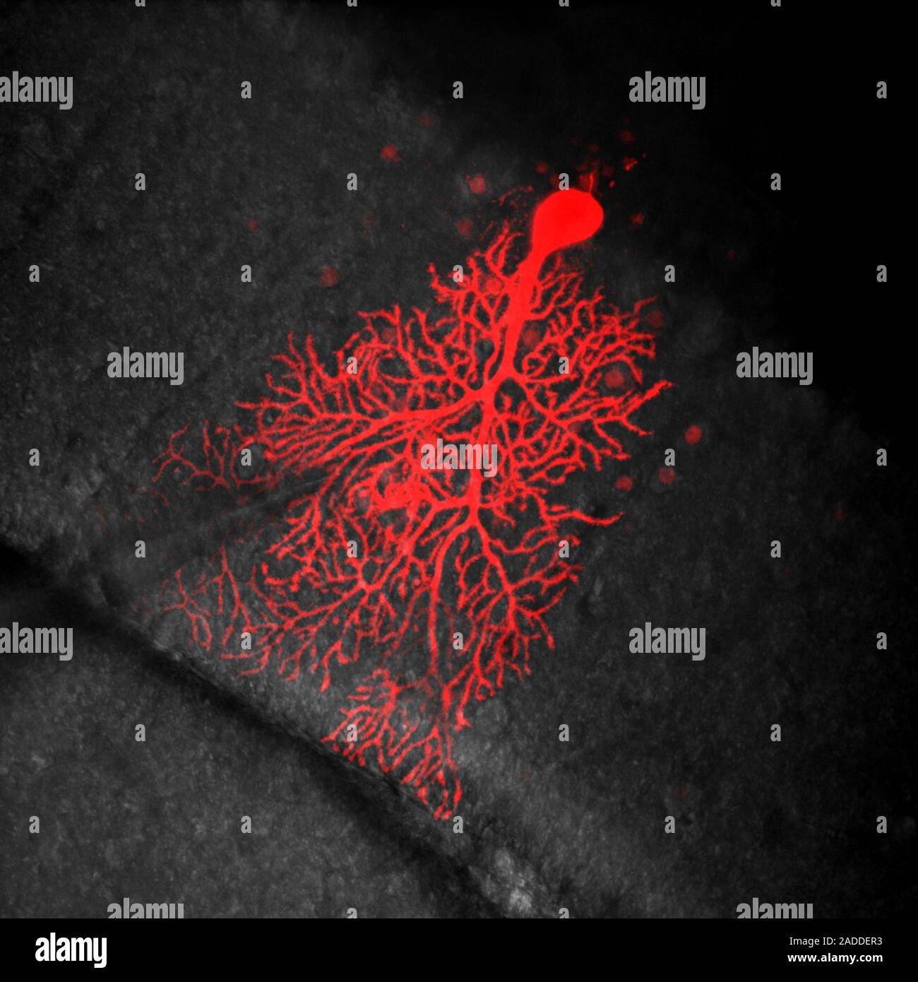 Coloured confocal light micrograph of a Purkinje neuron (nerve cell ...