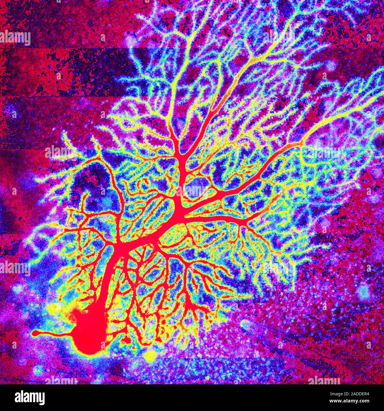 Coloured confocal light micrograph of a Purkinje neuron (nerve cell ...
