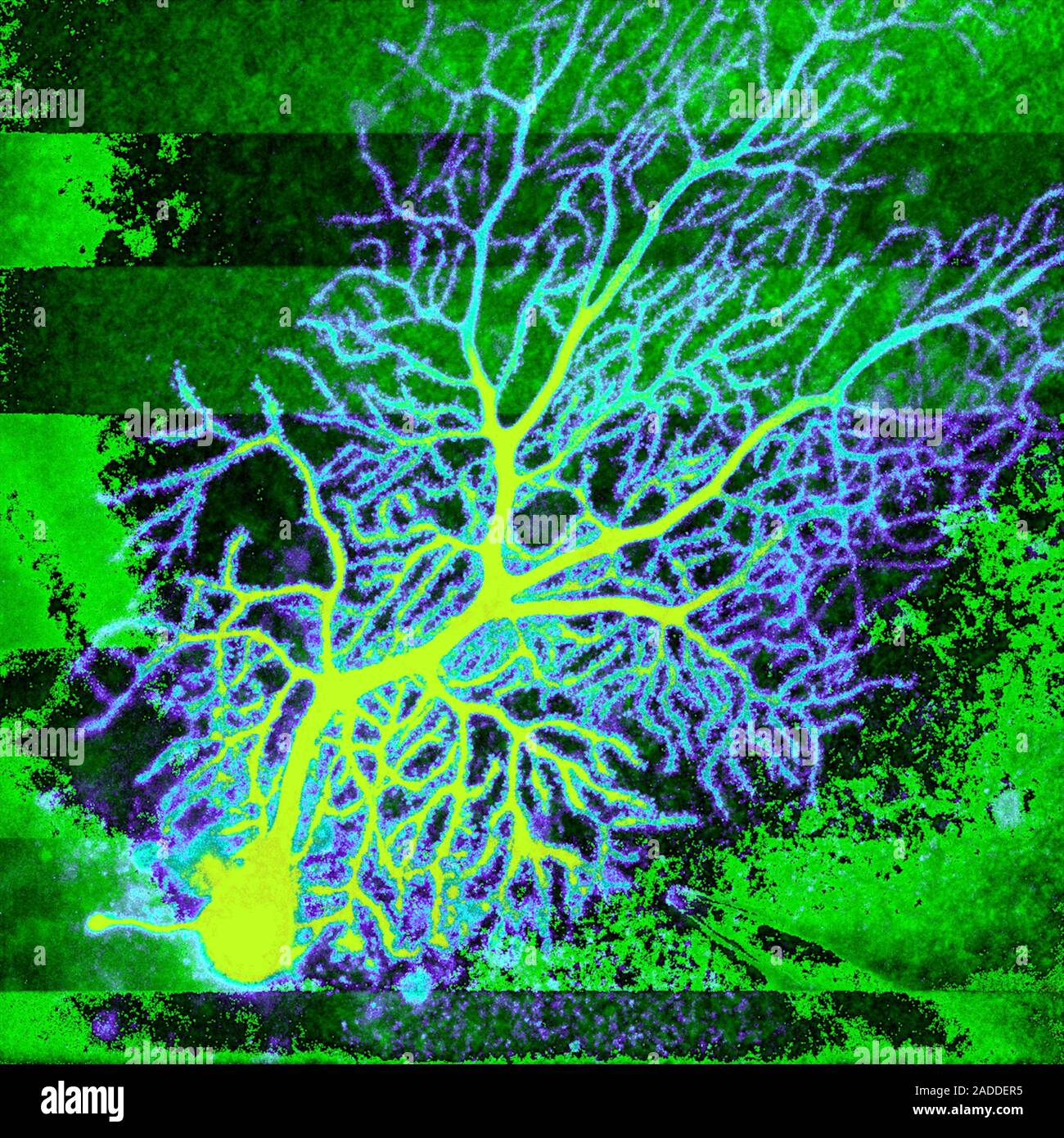 Coloured confocal light micrograph of a Purkinje neuron (nerve cell ...