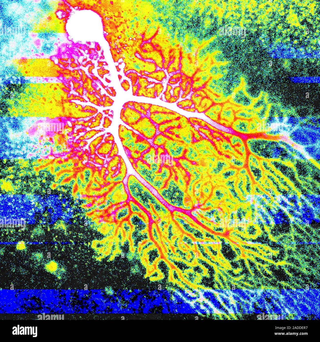 Coloured confocal light micrograph of a Purkinje neuron (nerve cell ...