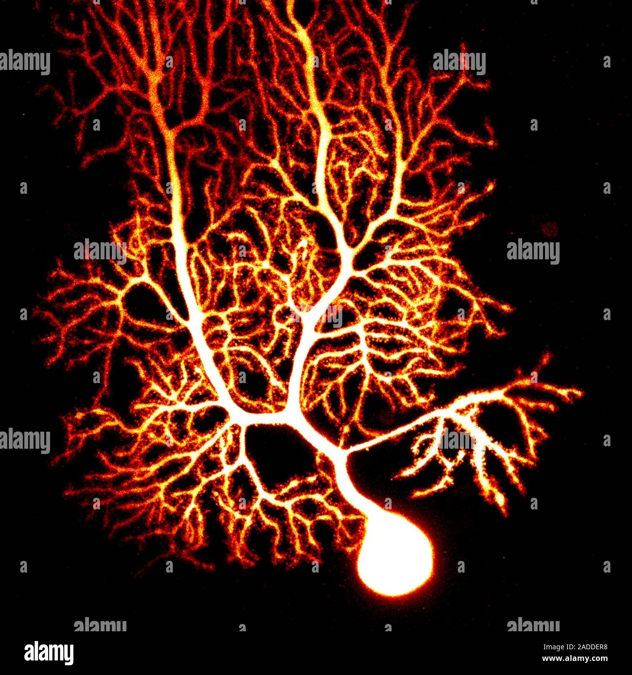 Coloured confocal light micrograph of a Purkinje neuron (nerve cell ...