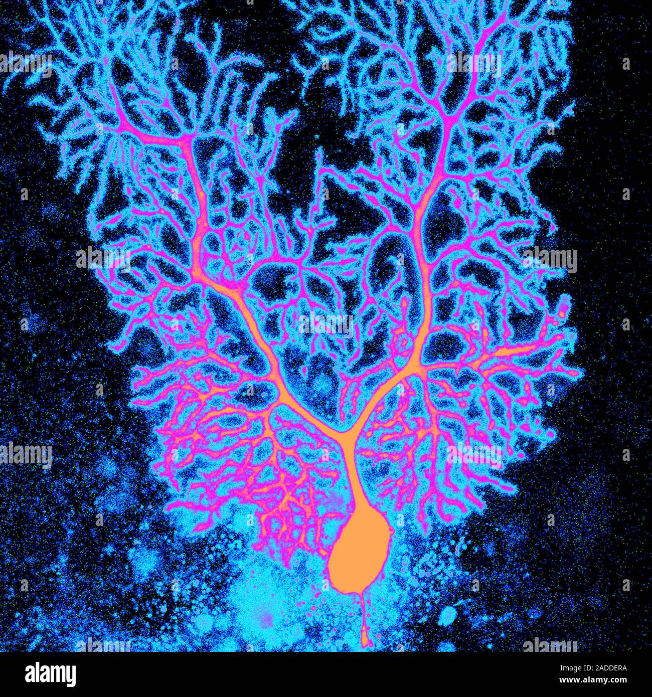Coloured confocal light micrograph of a Purkinje neuron (nerve cell ...