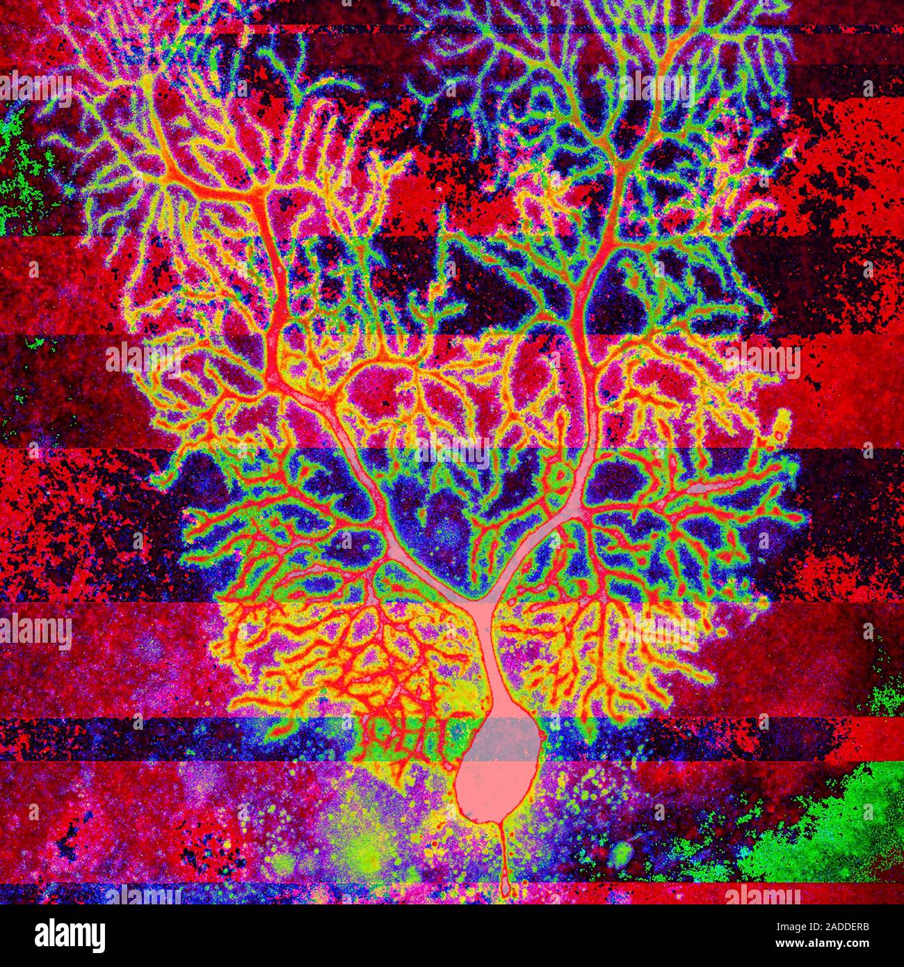 Coloured confocal light micrograph of a Purkinje neuron (nerve cell ...