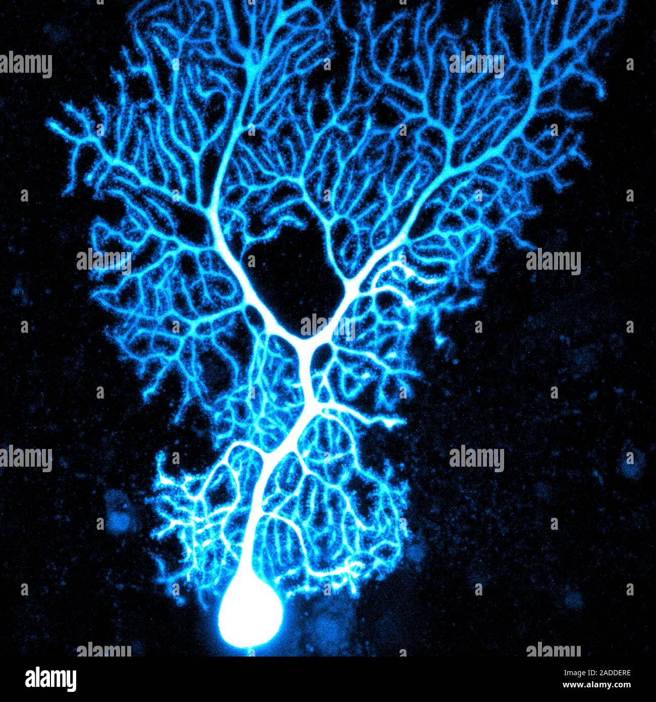 Coloured confocal light micrograph of a Purkinje neuron (nerve cell ...