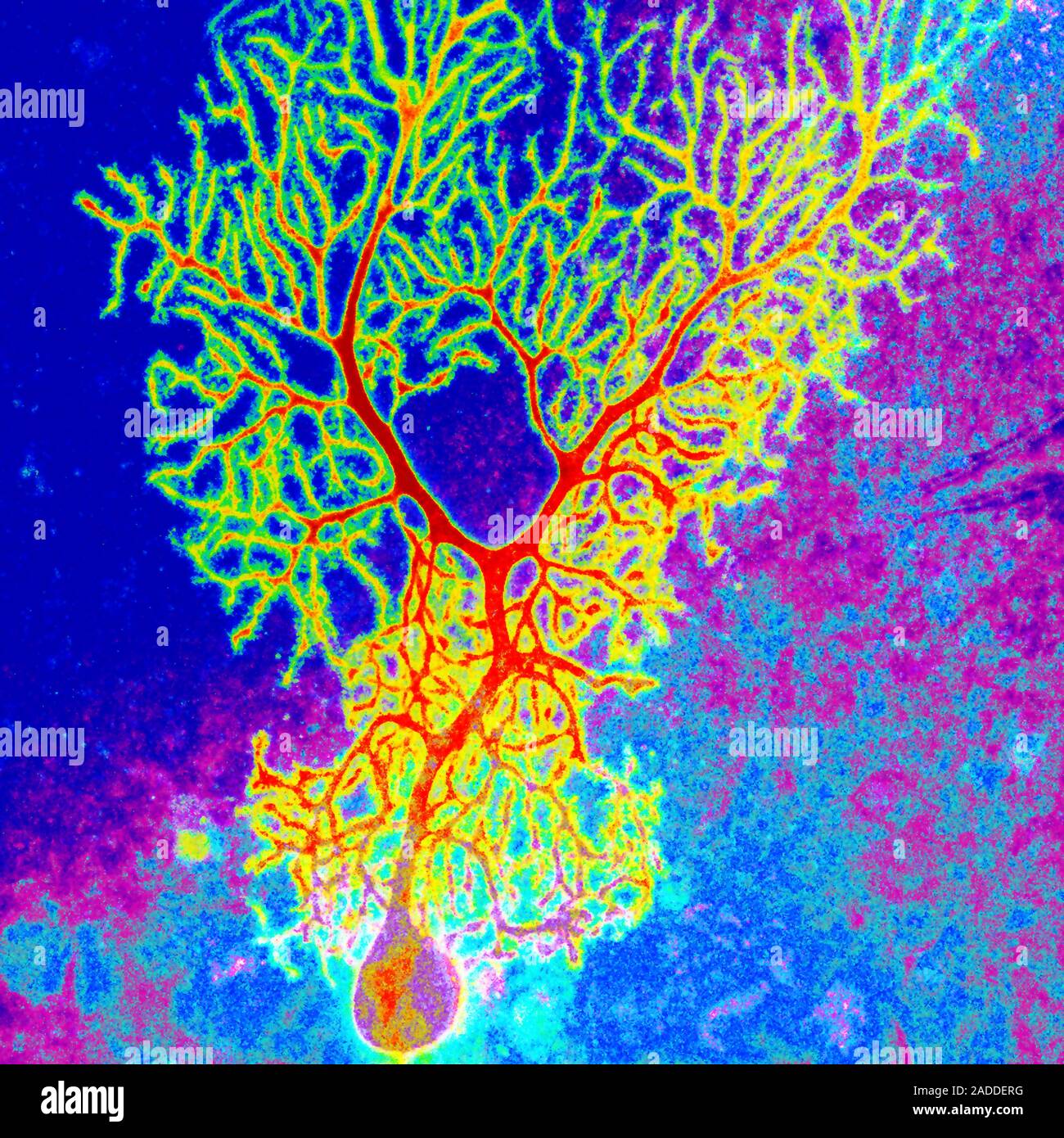 Coloured confocal light micrograph of a Purkinje neuron (nerve cell ...
