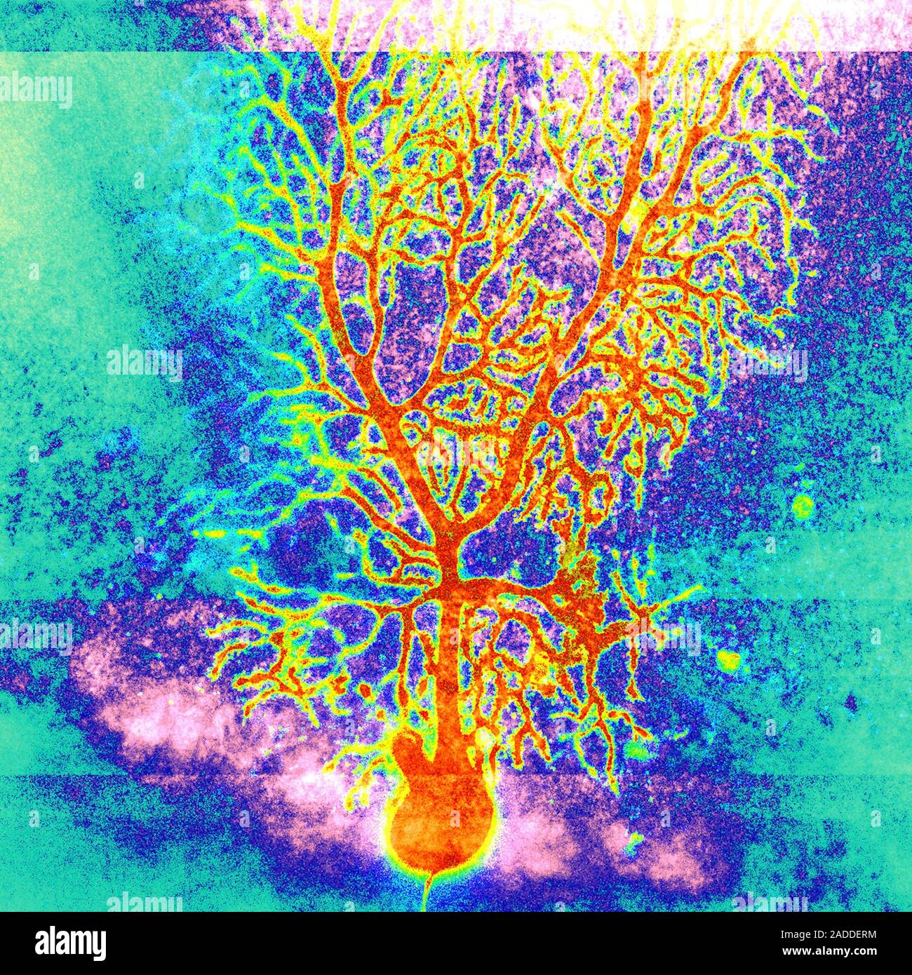 Coloured confocal light micrograph of a Purkinje neuron (nerve cell ...