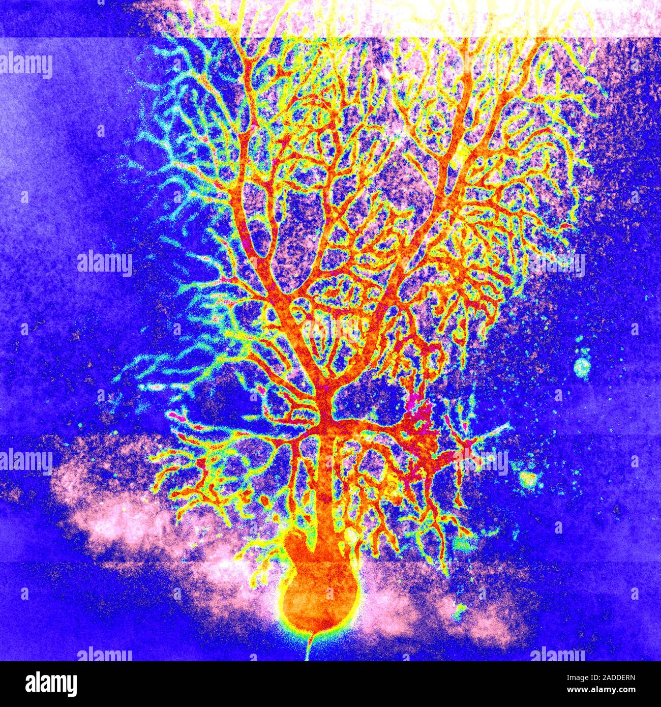 Coloured confocal light micrograph of a Purkinje neuron (nerve cell ...
