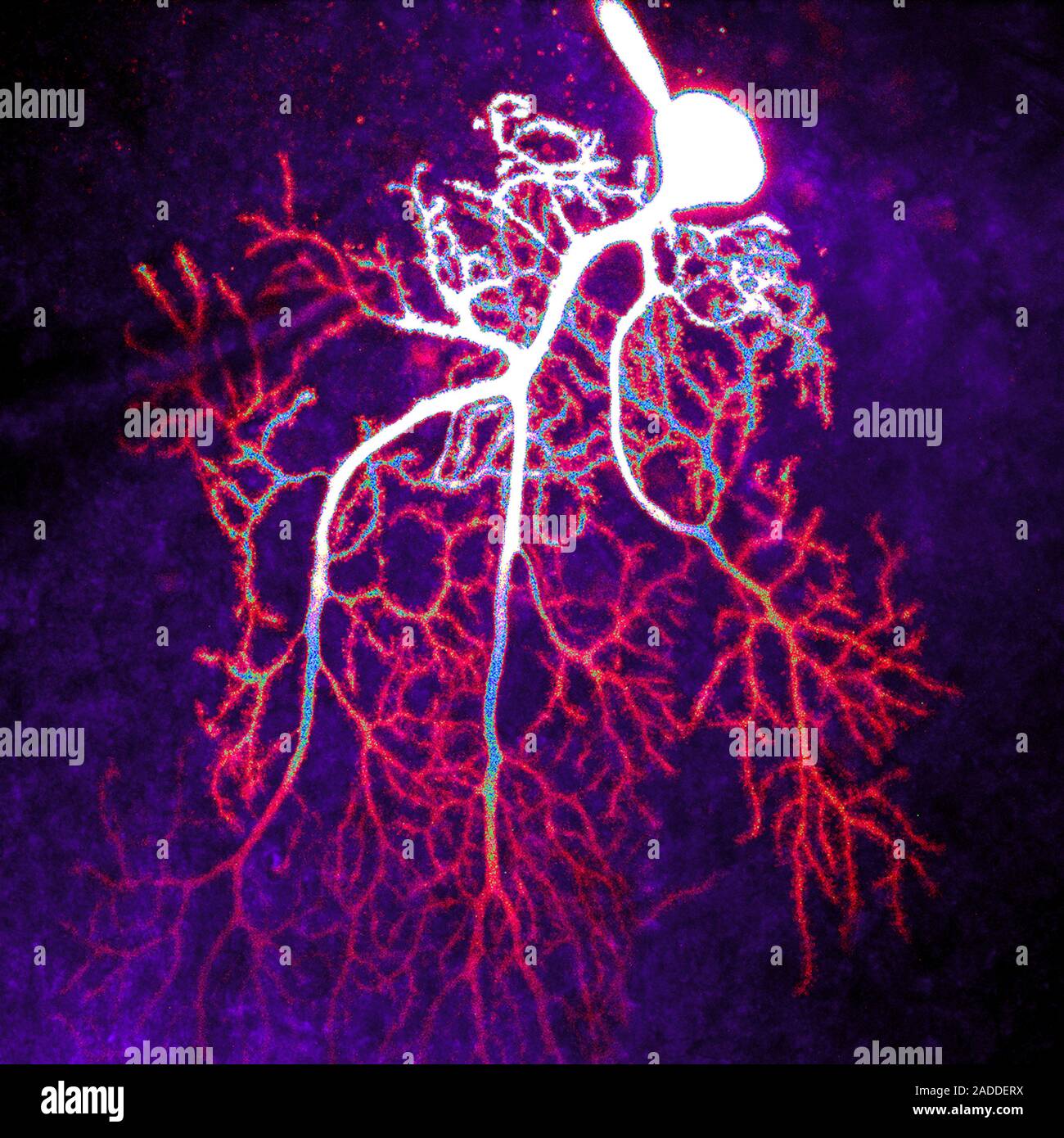 Coloured confocal light micrograph of a Purkinje neuron (nerve cell ...