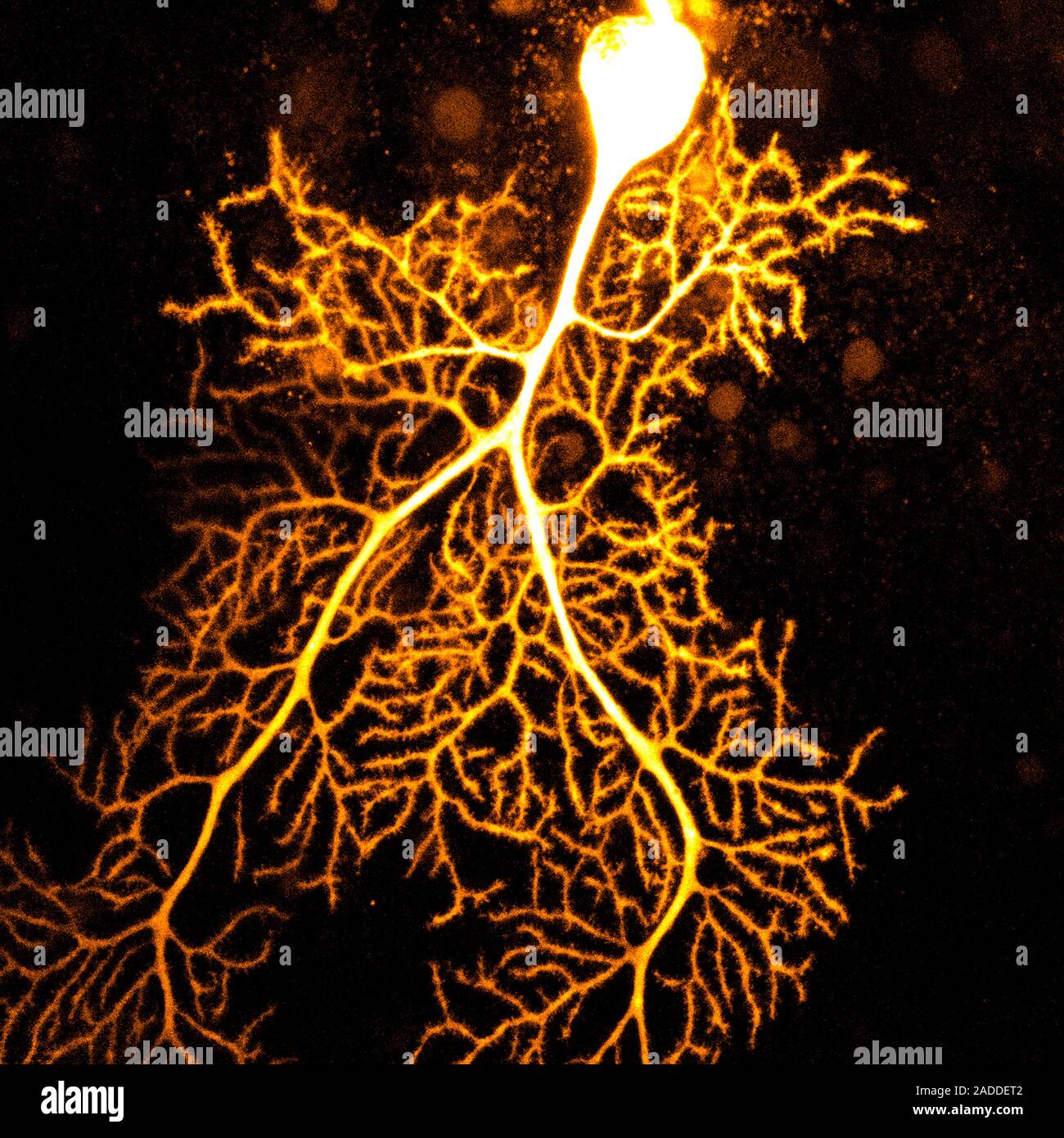 Coloured confocal light micrograph of a Purkinje neuron (nerve cell ...