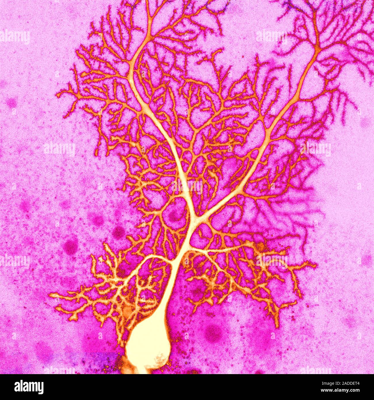 Coloured confocal light micrograph of a Purkinje neuron (nerve cell ...