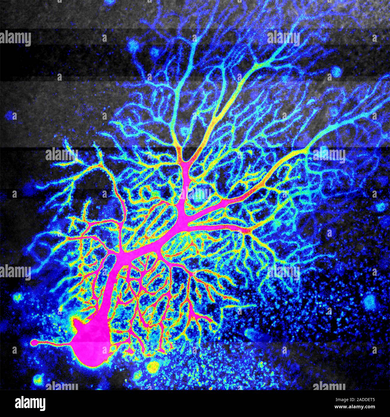 Coloured confocal light micrograph of a Purkinje neuron (nerve cell ...