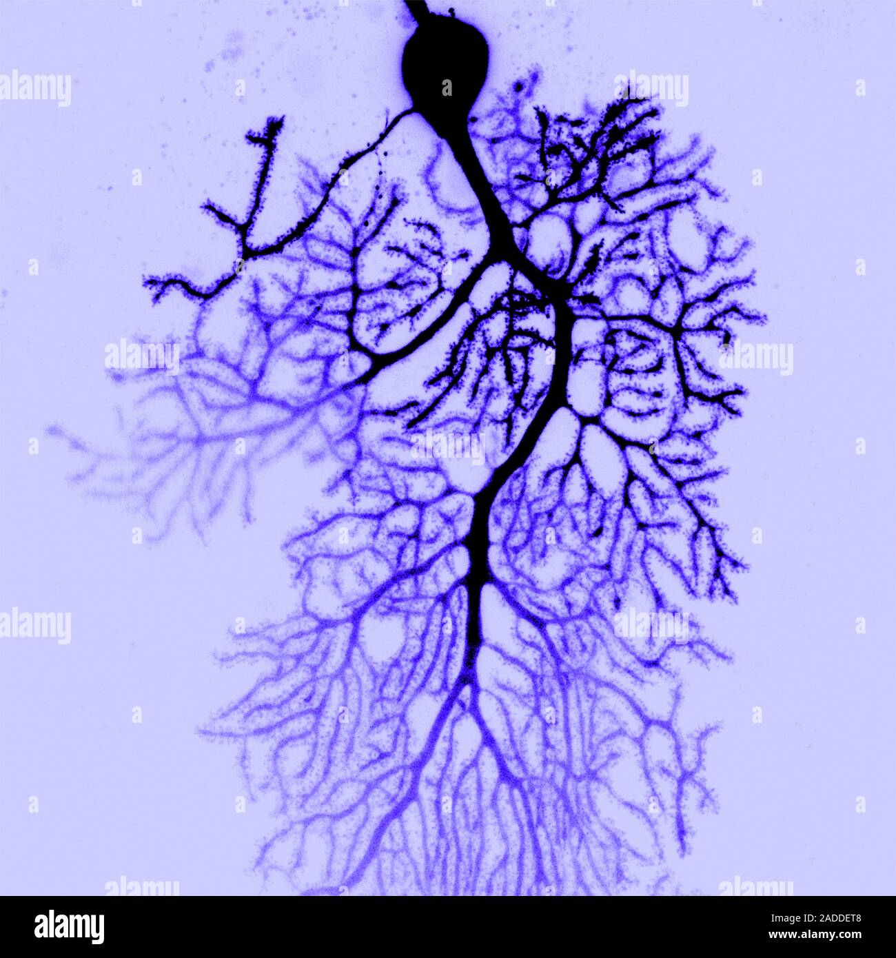 Coloured confocal light micrograph of a Purkinje neuron (nerve cell ...
