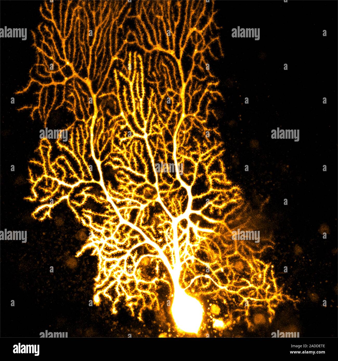 Coloured confocal light micrograph of a Purkinje neuron (nerve cell ...
