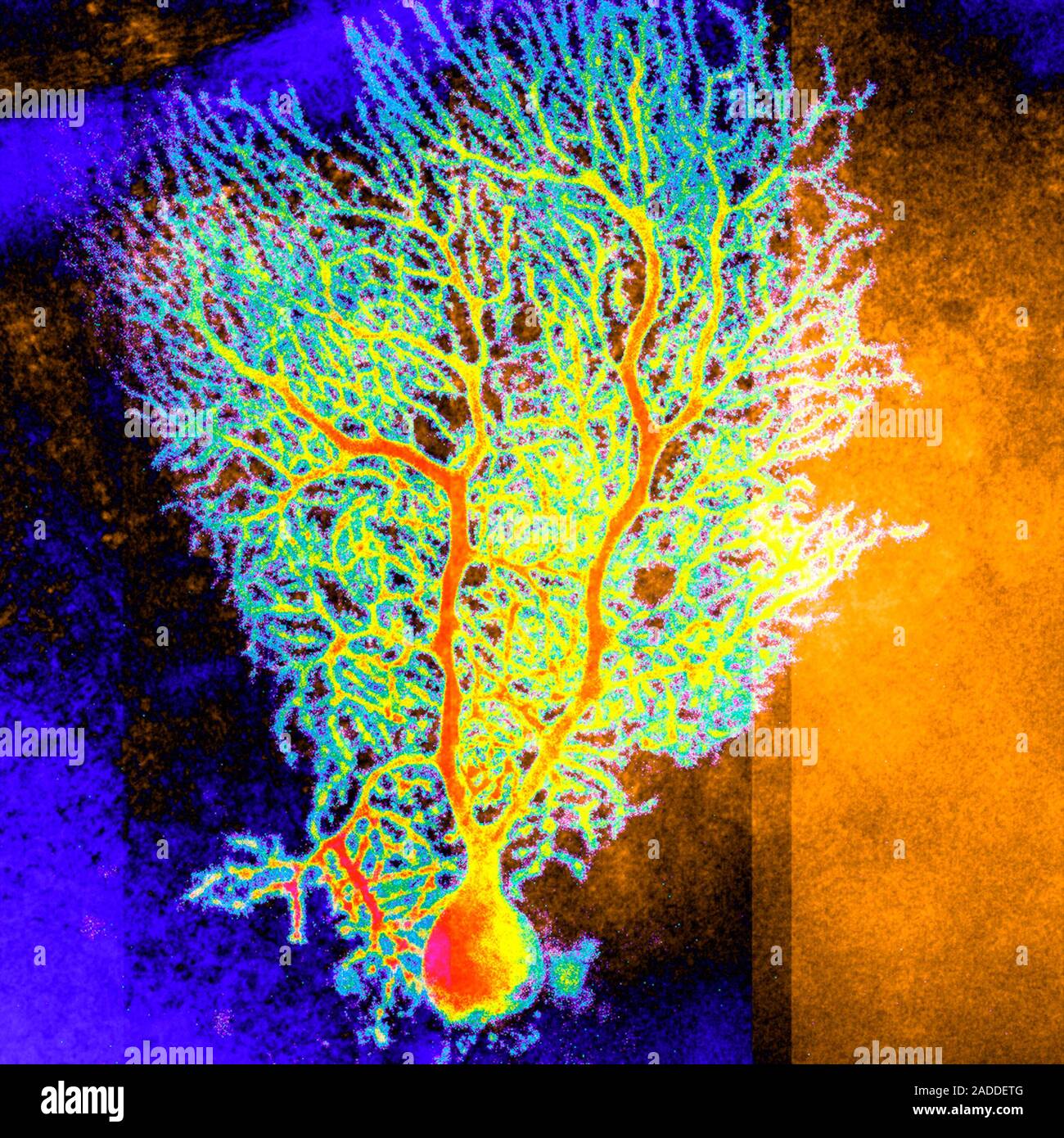 Coloured confocal light micrograph of a Purkinje neuron (nerve cell ...