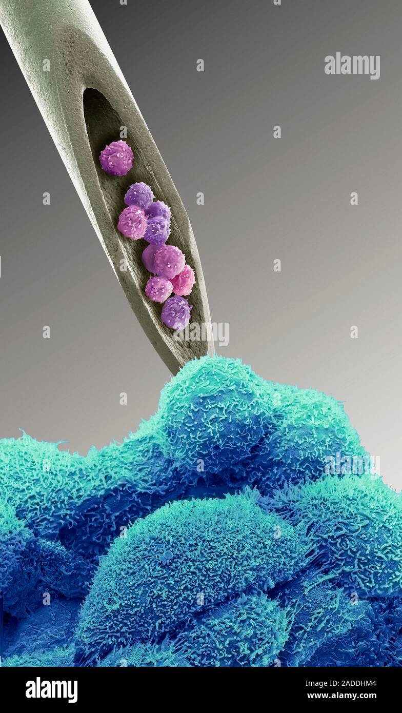Cell therapy, conceptual image. Composite coloured scanning electron