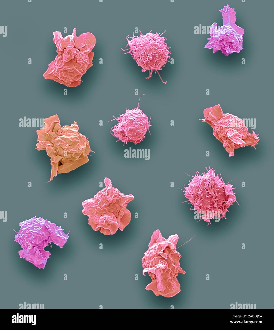 Jurkat cells. Coloured scanning electron micrograph (SEM) of several