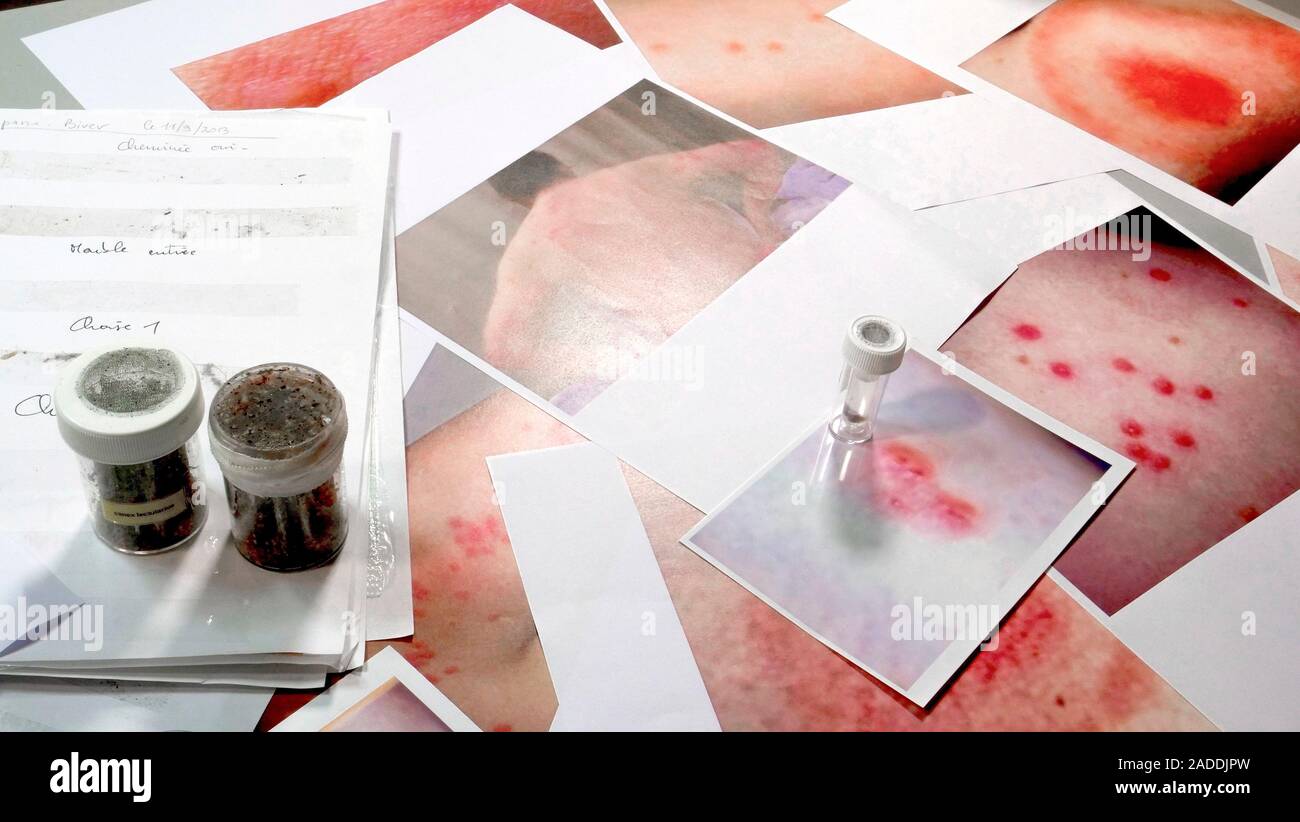 Bite and sting diagnoses. Array of photographs and sample containers