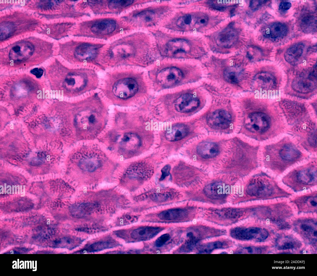 Light micrograph of a section through keratinocytes of the stratum ...