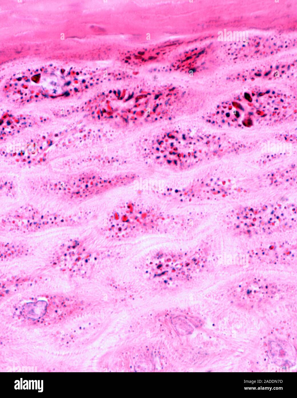 Light micrograph of epidermis showing the keratinocytes of granular