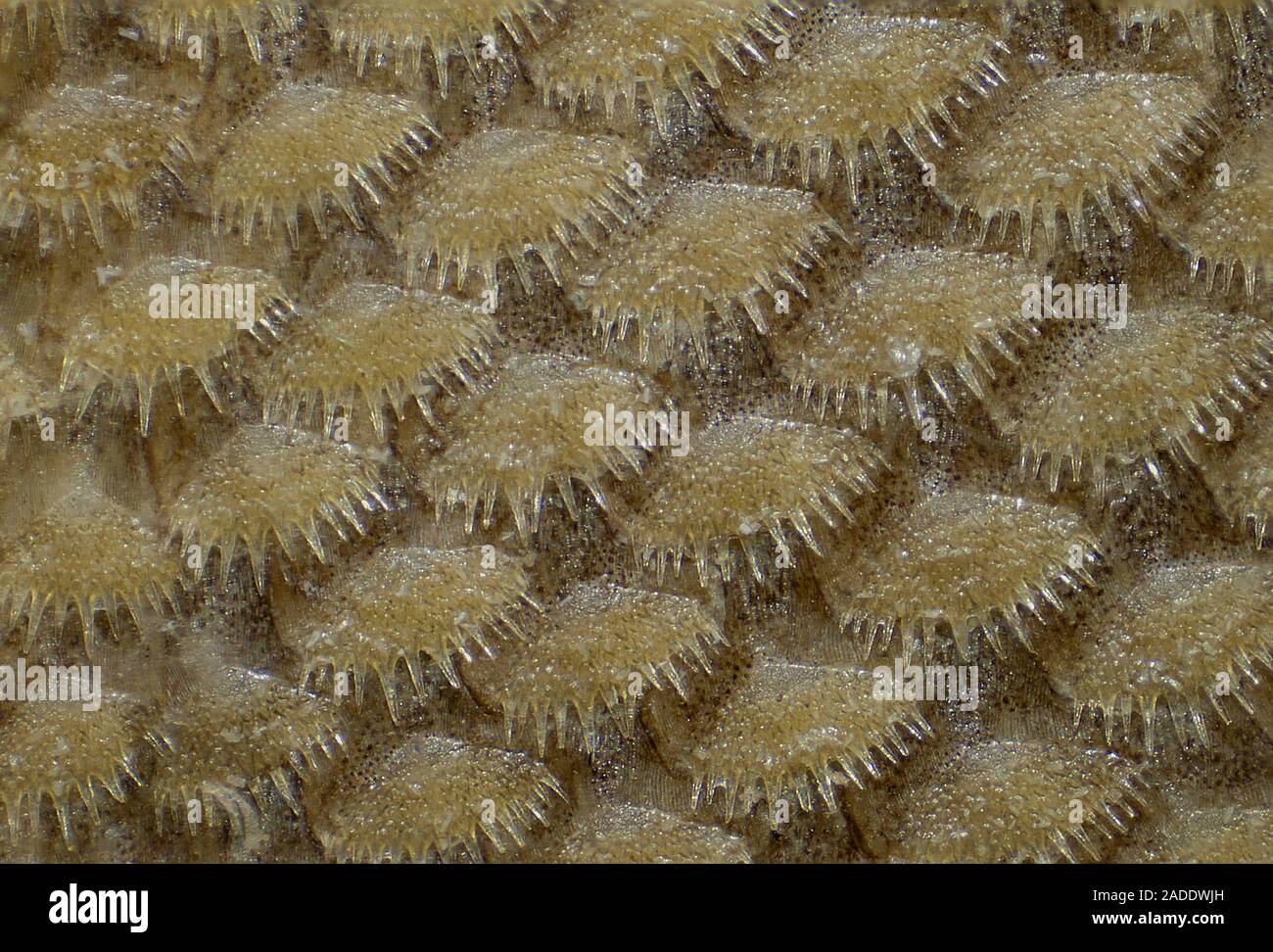 Skin of the Dover sole (Solea solea), showing ctenoid scales and chromatophores. Ctenoid scales