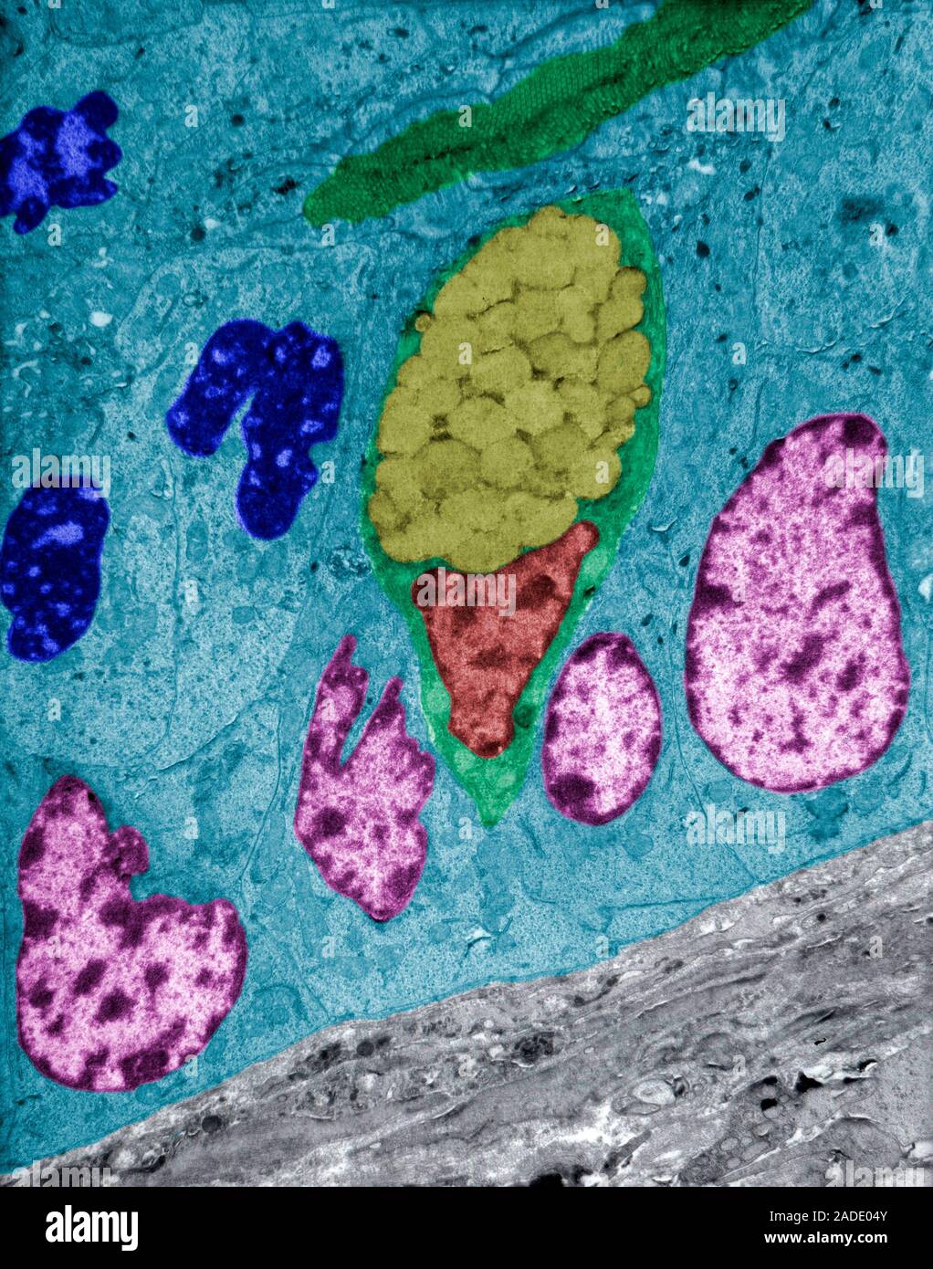 False colour transmission electron micrograph (TEM) showing the ...