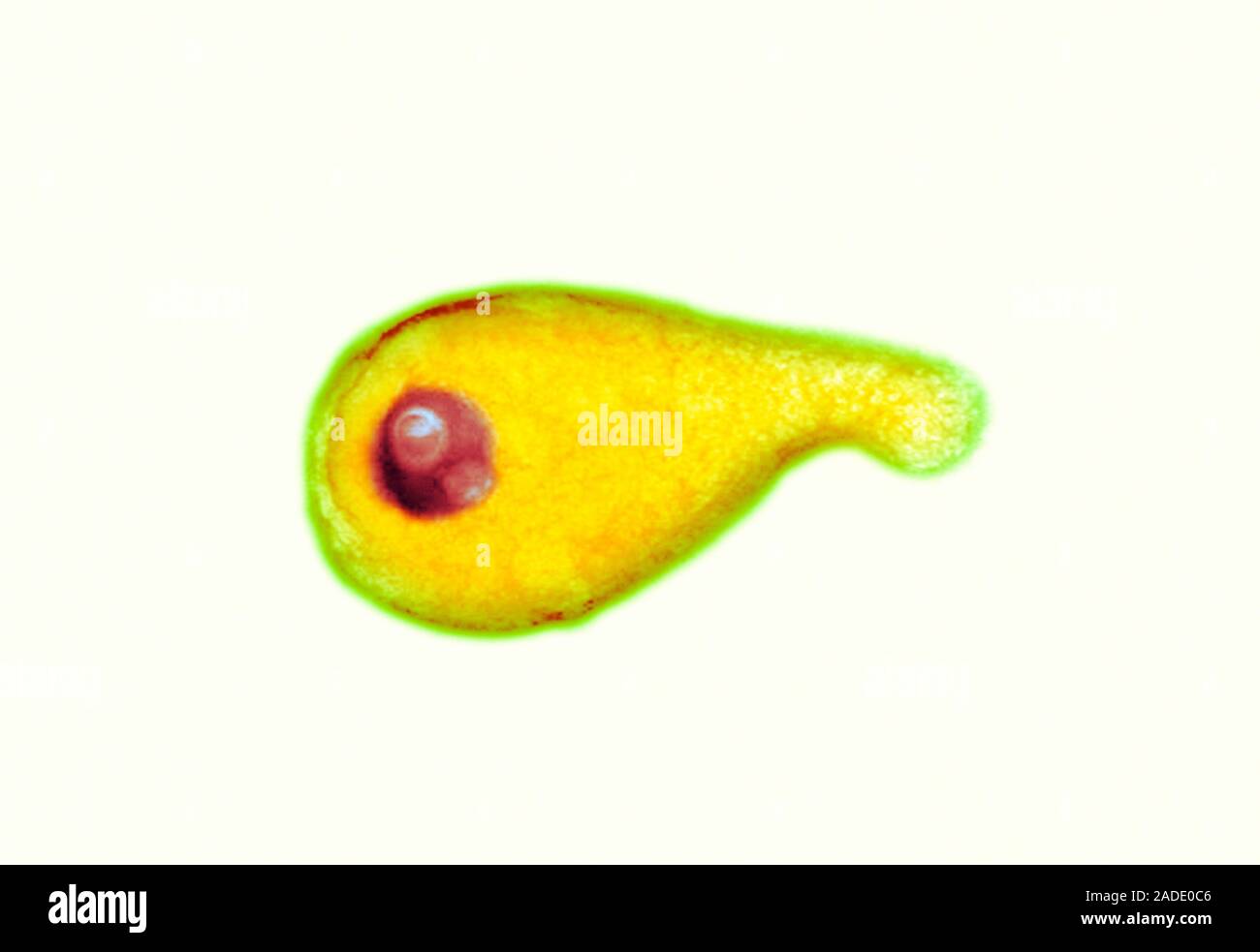 mycoplasma-genitalium-bacterium-coloured-transmission-electron