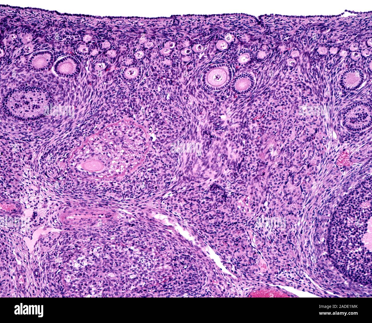 Low magnification light micrograph of the ovarian cortex showing, from ...