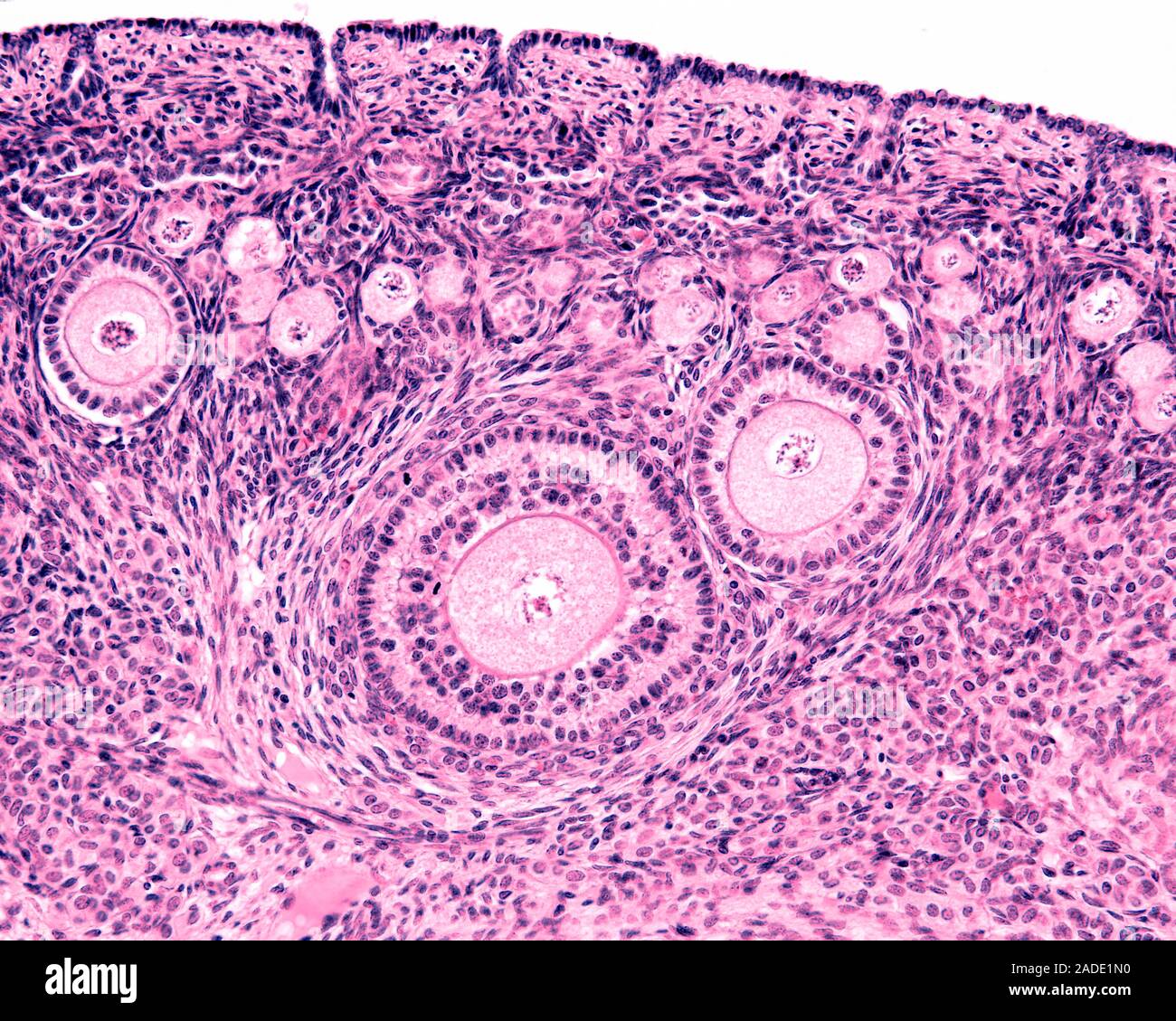 Light micrograph of the ovarian cortex showing, from top to bottom, the ...