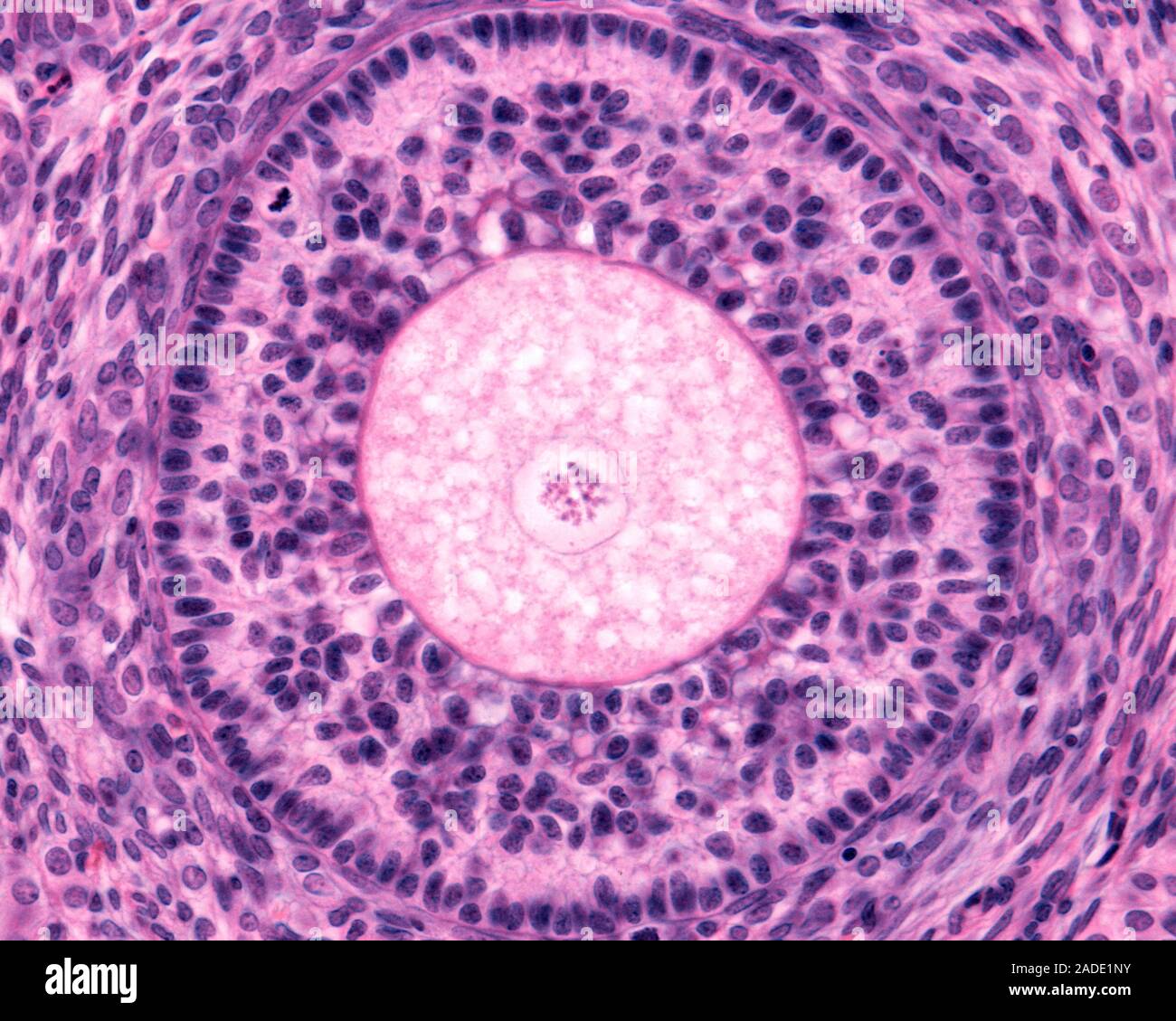light-micrograph-of-a-secondary-follicle-showing-oocyte-zona-pellucida