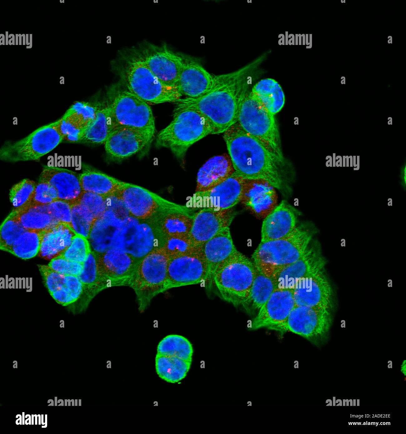 Confocal light micrograph of cultured human colon cancer cells ...