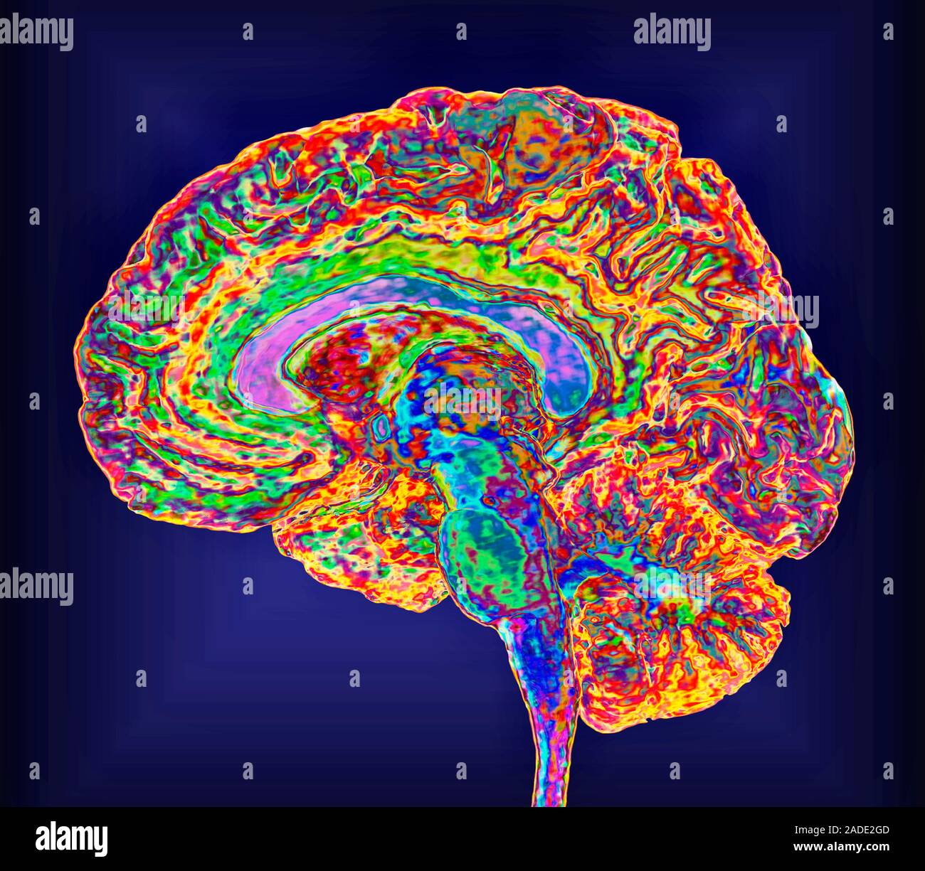 Magnetic Resonance Imaging Of The Sagittal Structures In The Brain