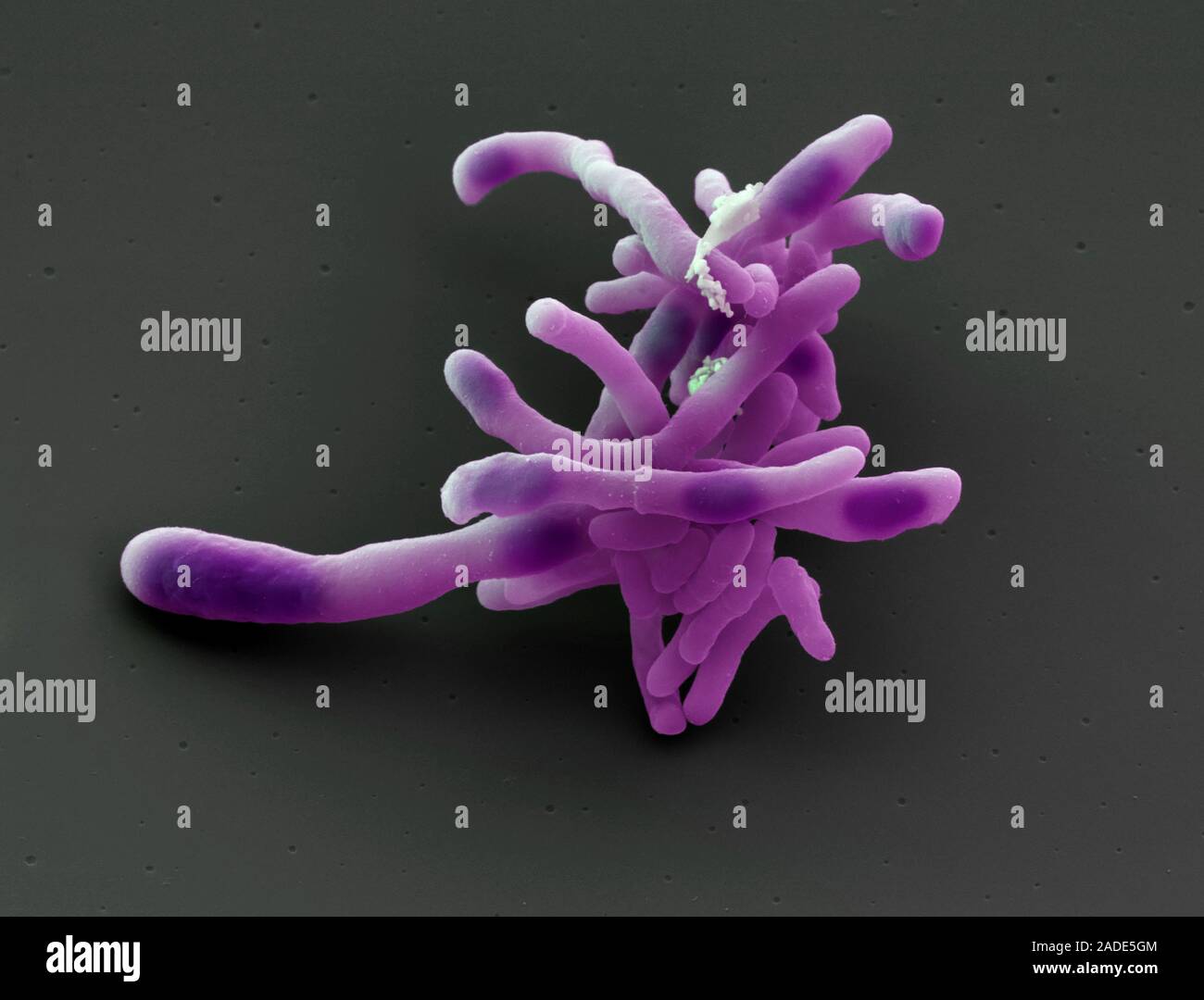 Corynebacterium diphtheriae bacteria, coloured scanning electron