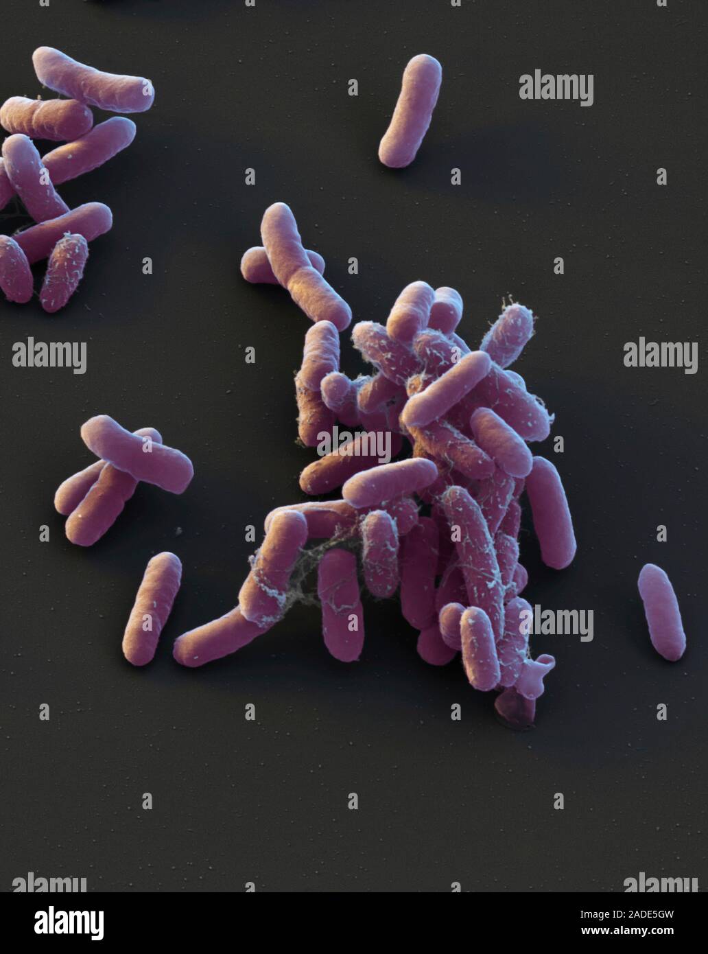 Enterobacter Cloacae Bacteria, Coloured Scanning Electron Micrograph 