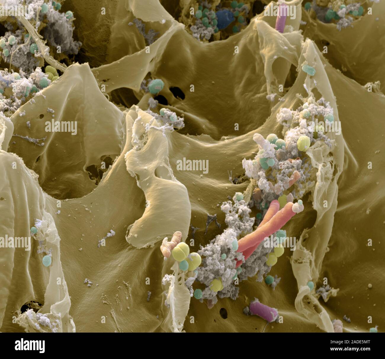 Sauerkraut bacteria. Coloured scanning electron micrograph (SEM