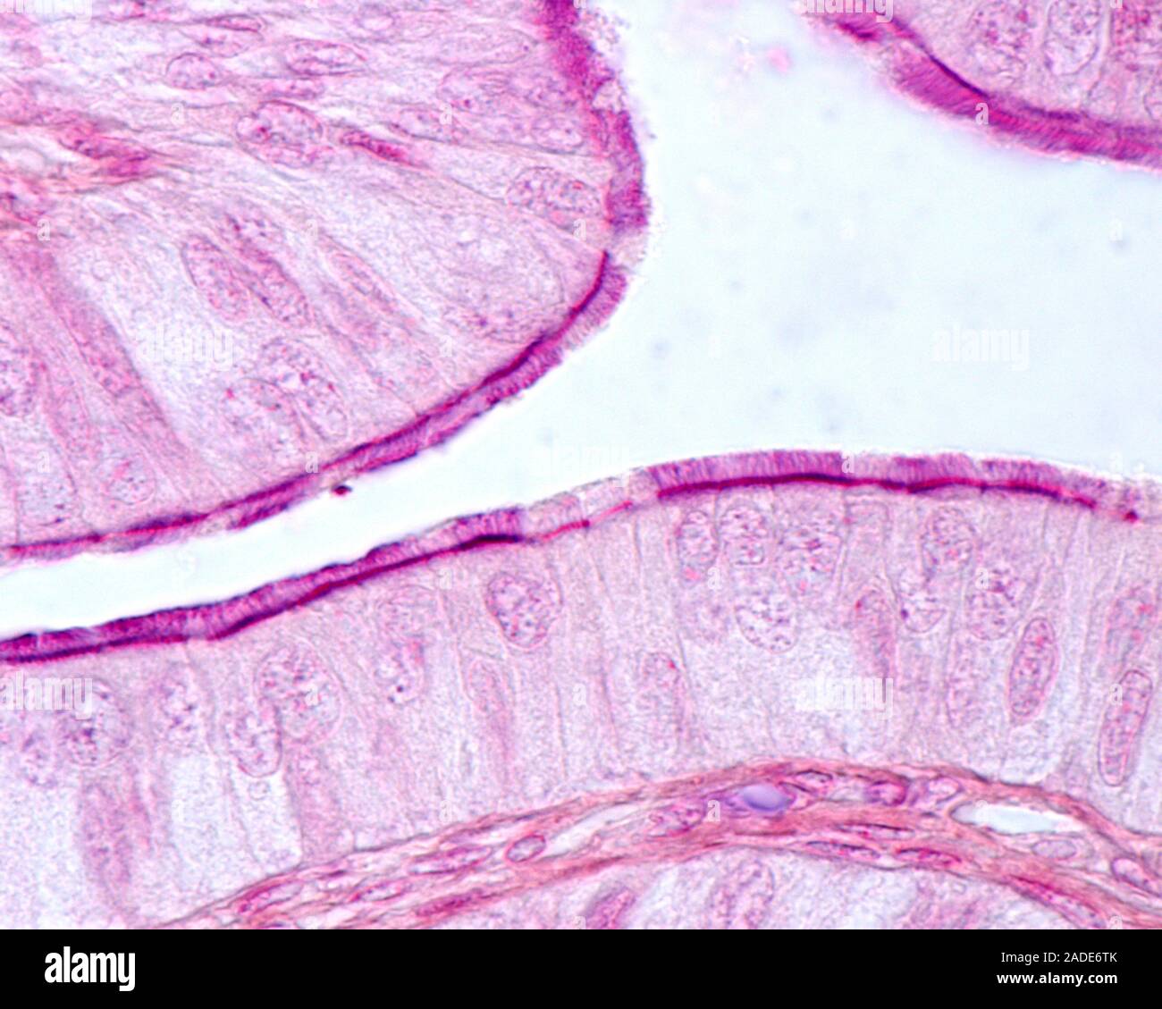 High magnification light micrograph showing the lining of a fallopian ...