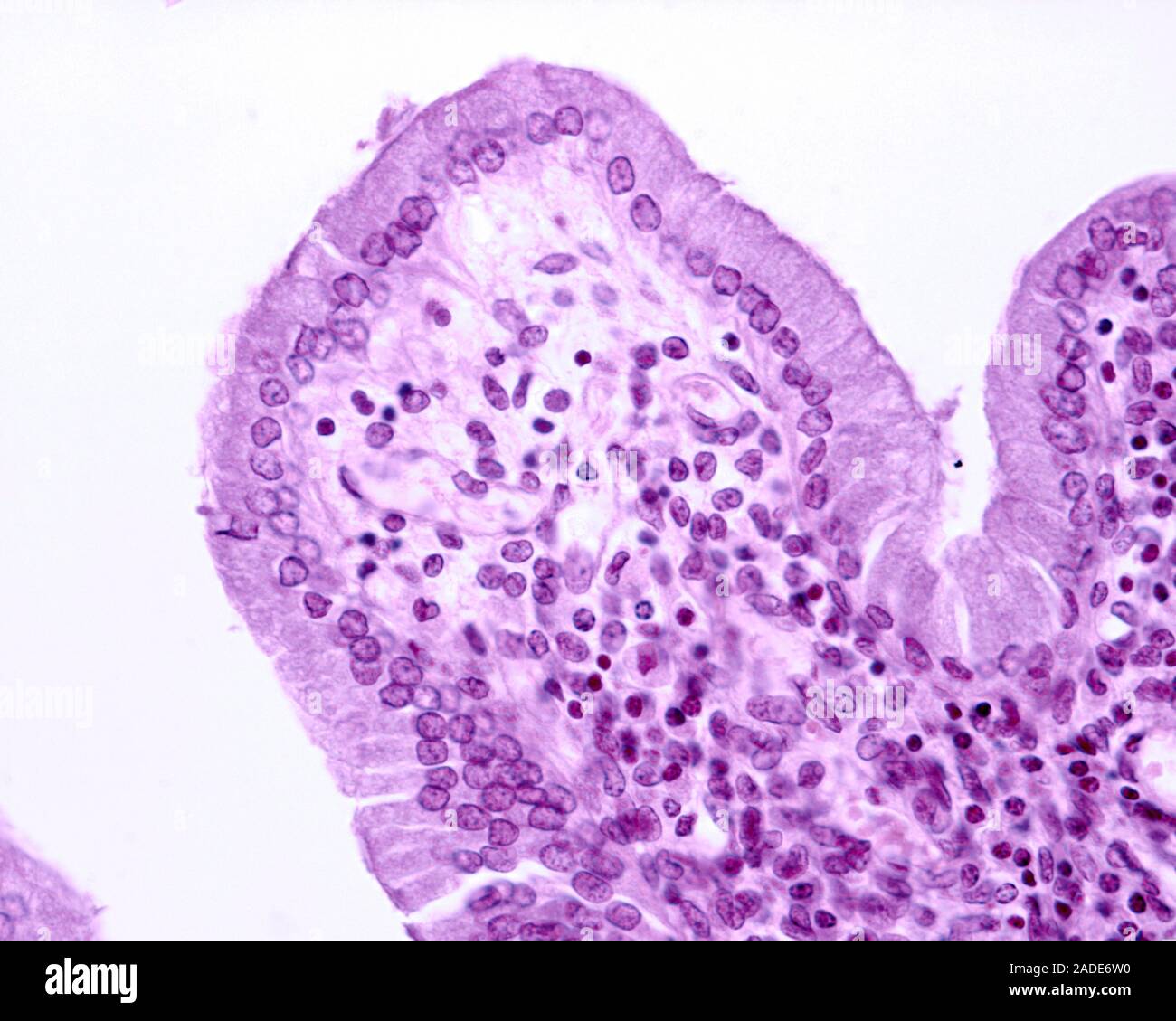 Epithelial lining of the endocervix, light micrograph. This is a simple