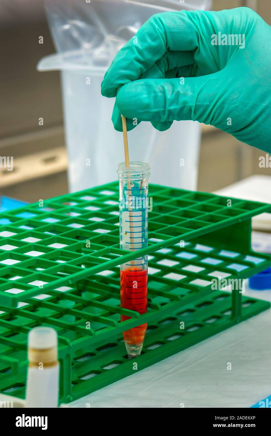 Stool sample diagnostic testing. A stool sample is mixed with cell