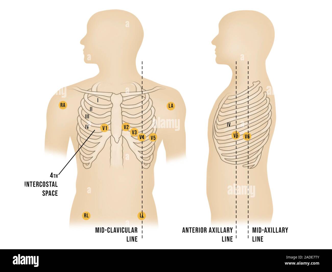 Placement of ECG electrodes, illustration. Electrocardiography is a ...