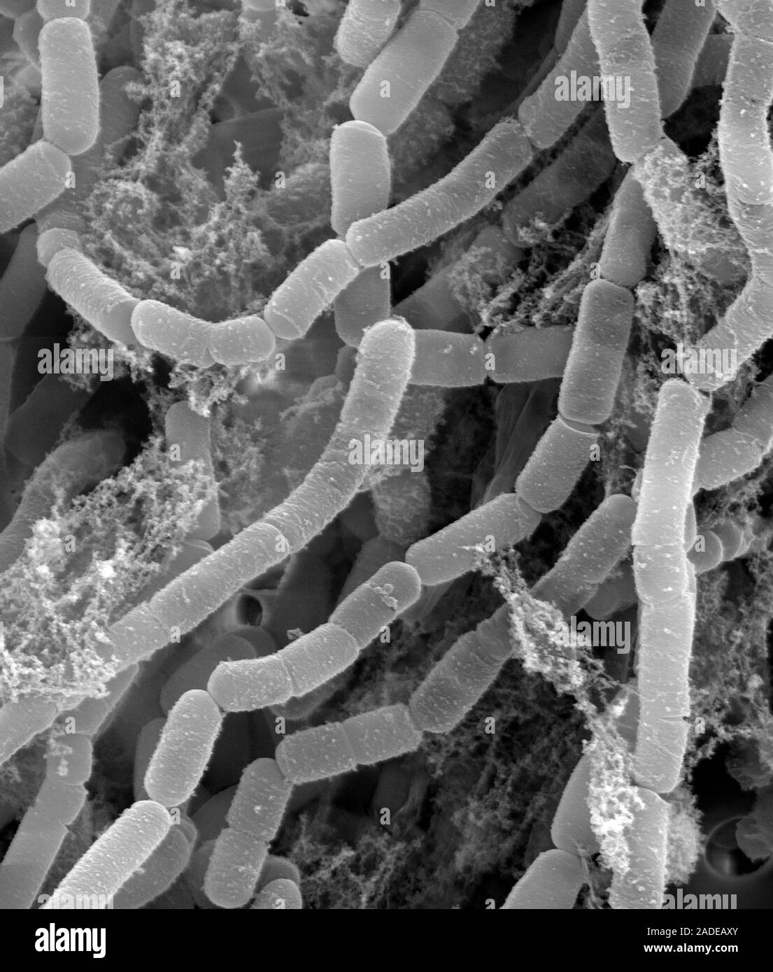 Streptomyces lydicus bacteria, scanning electron micrograph (SEM). This ...