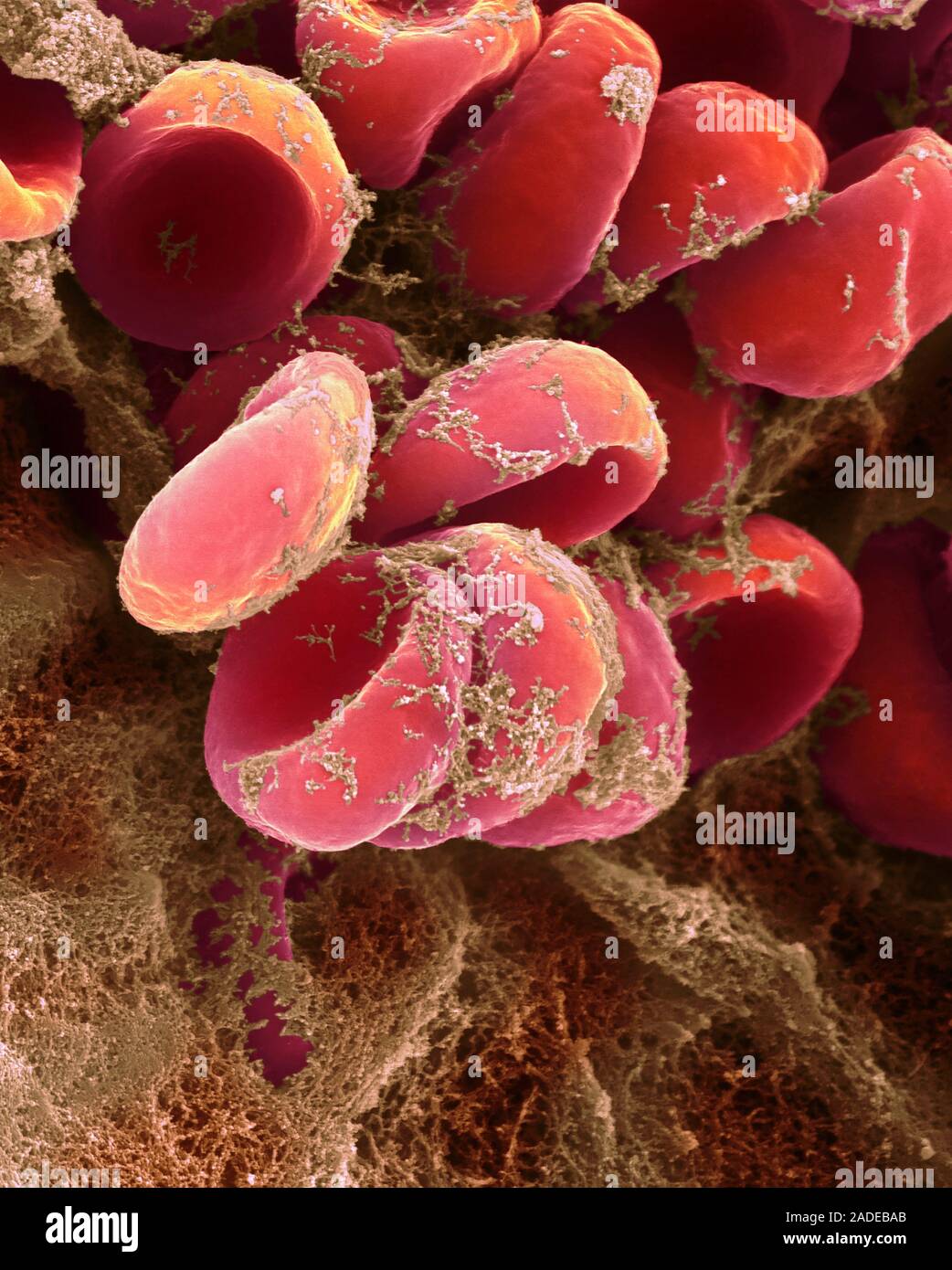 Coloured scanning electron micrograph (SEM) of red blood cells in a ...