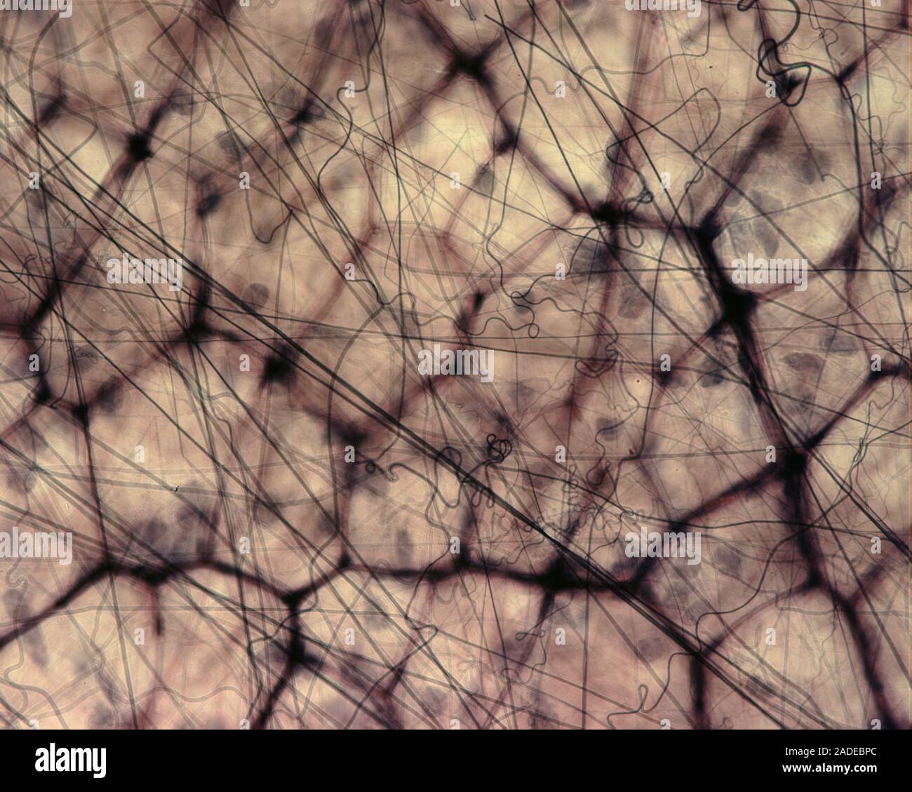 Areolar loose connective tissue, light micrograph. This type of loose ...