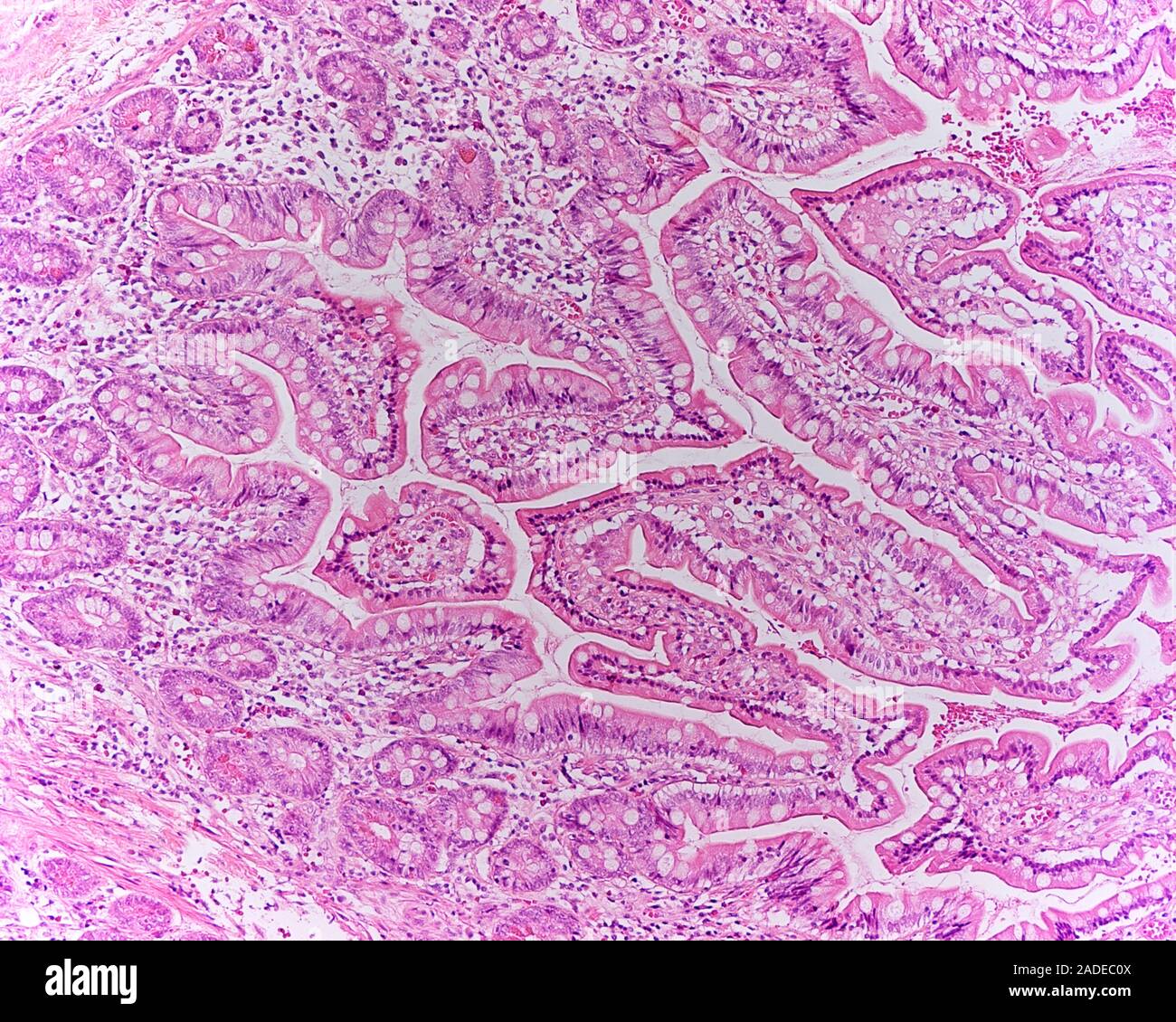 Stomach tissue. Light micrograph of a section through glandular mucosal