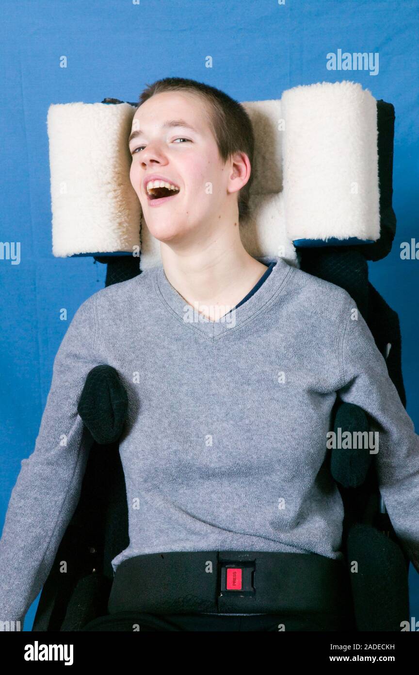 Young woman with Cerebral Palsy whose chair has a fur covered head rest