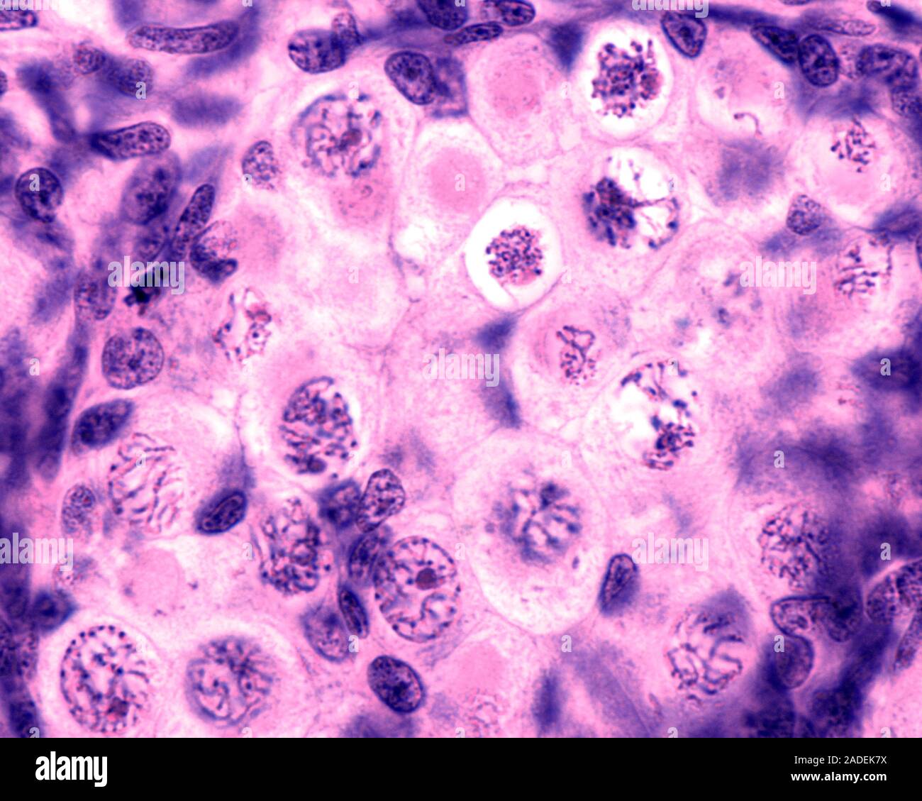 Light micrograph of a fetal ovary showing several oocytes (immature egg ...