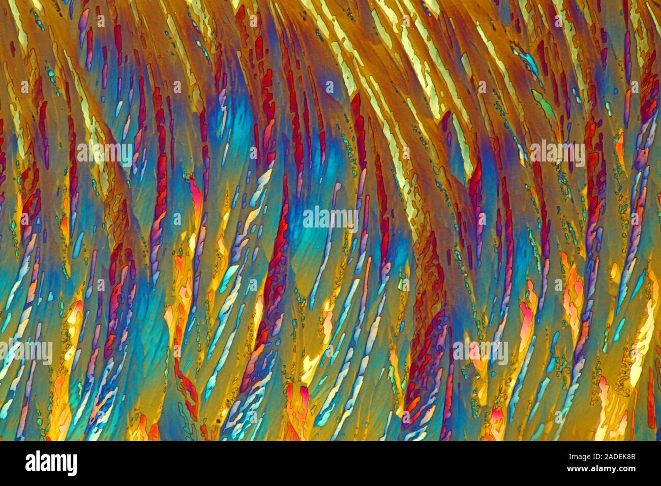 Calluses Lighting Callus remover crystals, polarized light micrograph. Callus remover ...