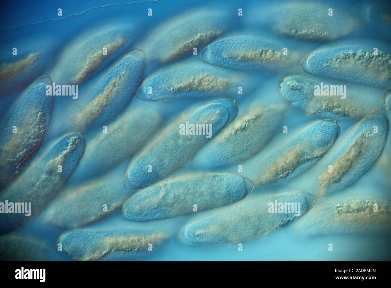 What Turns Tiny Fly Eggs Into Sudden, Jaw-Dropping Transformations