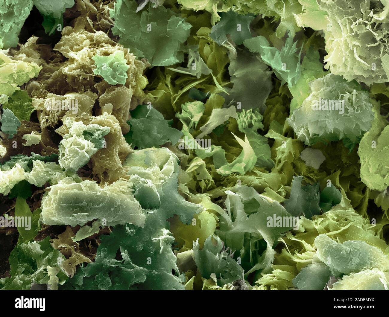 Fatberg. Coloured scanning electron micrograph (SEM) of the surface of ...