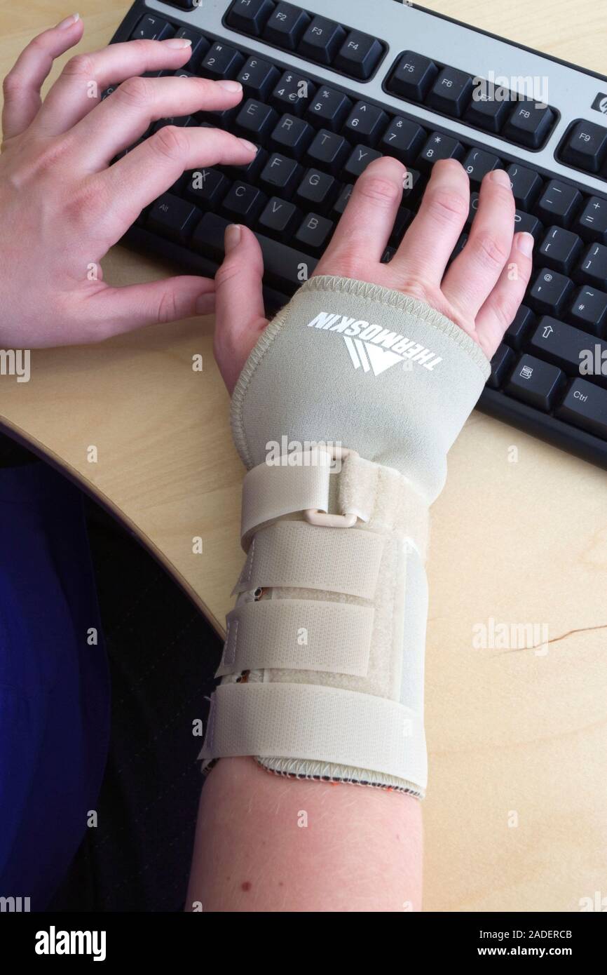 Office worker typing on a computer whilst wearing an elasticated wrist support to help alleviate repetitive strain injury (RSI), RSI most commonly aff Stock Photo