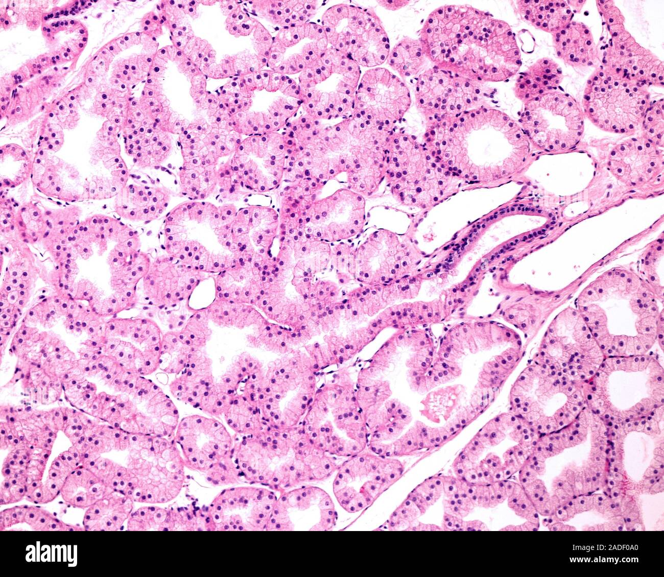 Light micrograph showing secretory units of a lacrimal gland. The