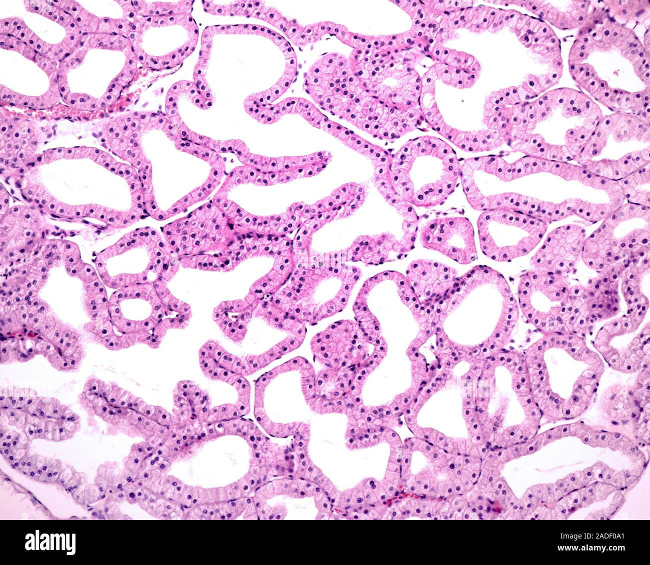 Light micrograph showing secretory units of a lacrimal gland. The